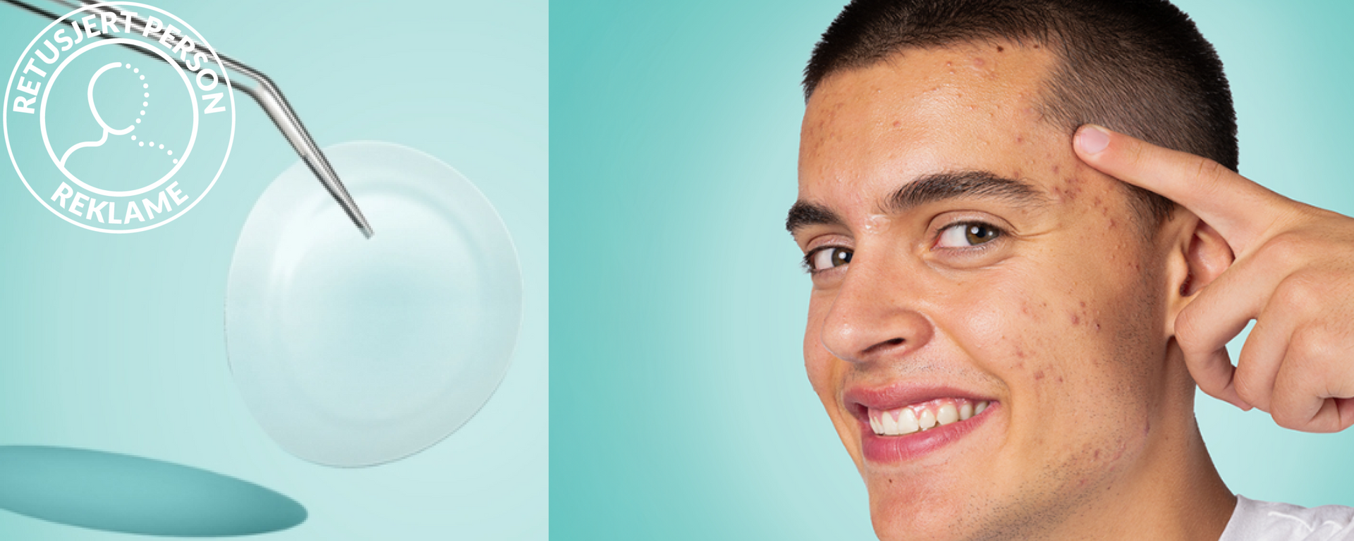 banner pimples n